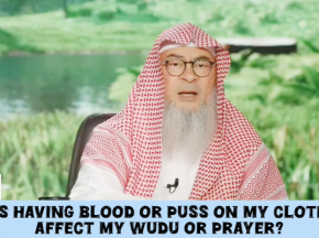 Does having blood or pus on my clothes affect my wudu or prayer? #islam #islamic assim al hakeem