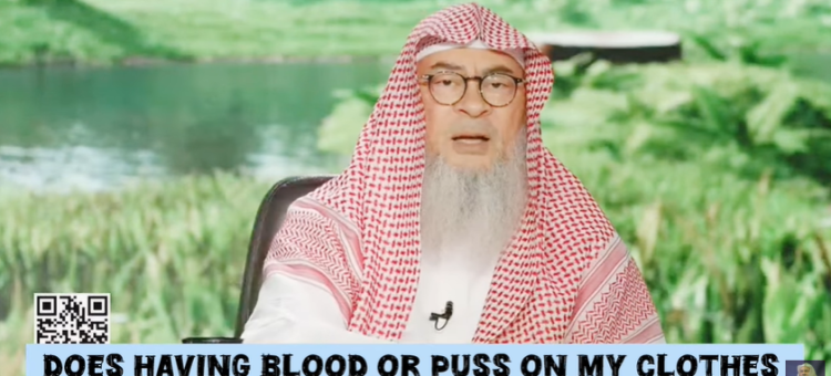 Does having blood or pus on my clothes affect my wudu or prayer? #islam #islamic assim al hakeem