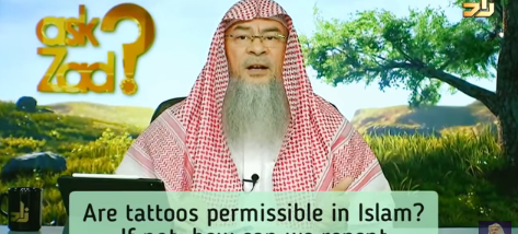 Are Tattoos permissible in Islam? What to do if we already have Tattoos?