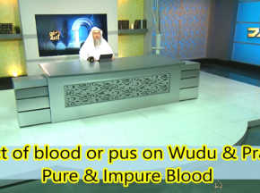 Does Human Blood & Pus on body or clothes invalidate Wudu & Prayer?