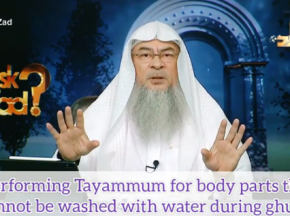 Performimg tayammum if you cannot do ghusl due to skin condition