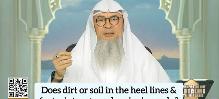 Does dirt, soil in heel lines & footprints act as a barrier in wudu? #assimalhakeem